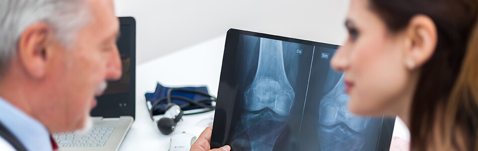 Osteoporoza - kad kosti postanu krte i lomljive